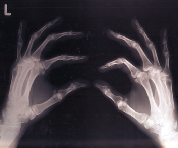 object #3: bones