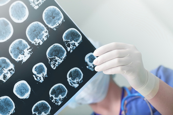 Alztesting.jpg
