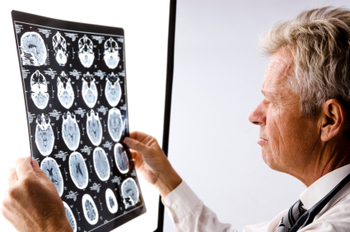 deep_brain_stimulation